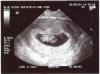 Taken On June 2nd 2004