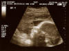 Taken On October26th 2004