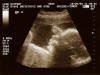 Taken On October26th 2004