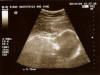 Taken On September 24th 2004